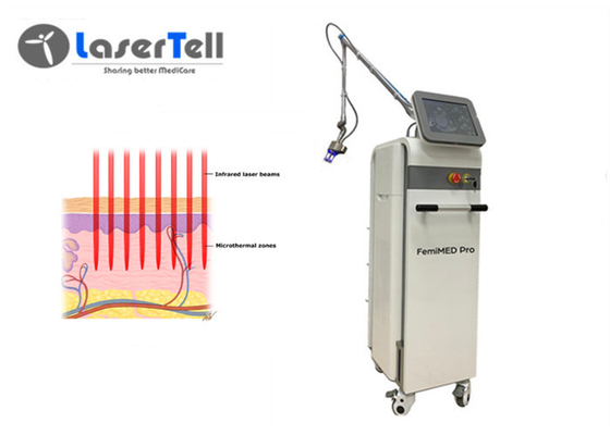 ISO Lasertell 10.4 인치 스크린 이산화탄소 분수 레이저 장비